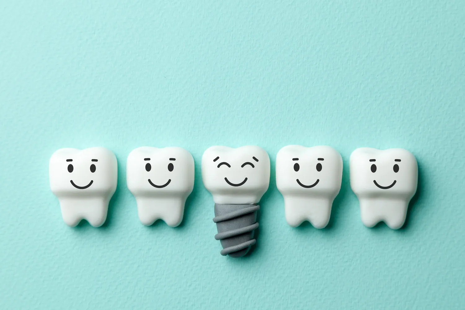 Czy implanty zębów można odliczyć od podatku?