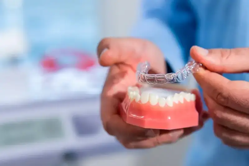 Invisalign kiedy efekty?